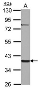 ZNF302 Antibody - Sample (30 ug of whole cell lysate) A: NT2D1 10% SDS PAGE ZNF302 antibody diluted at 1:2000