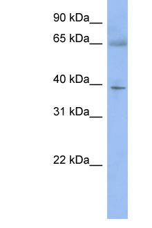 ZNF302 Antibody - ZNF302 antibody Western blot of Mouse Thymus lysate. Antibody concentration 1 ug/ml. This image was taken for the unconjugated form of this product. Other forms have not been tested.
