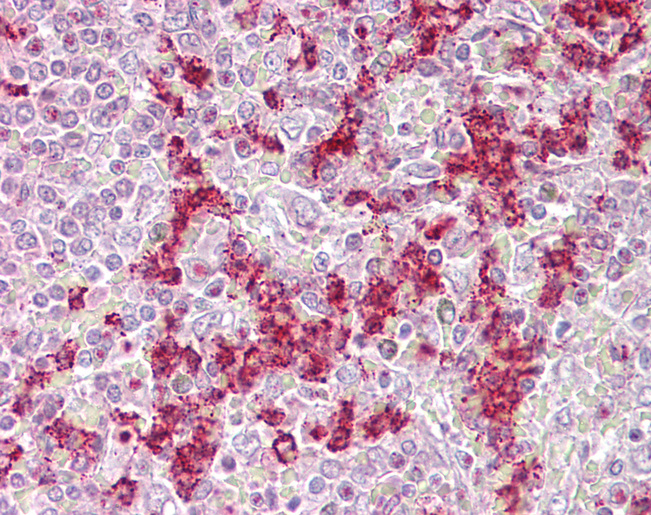 ZNF307 Antibody - Anti-ZKSCAN4 / ZNF307 antibody IHC of human spleen. Immunohistochemistry of formalin-fixed, paraffin-embedded tissue after heat-induced antigen retrieval. Antibody concentration 5 ug/ml.  This image was taken for the unconjugated form of this product. Other forms have not been tested.