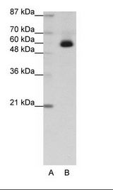 ZNF307 Antibody - Transfected 293T Cell Lysate.  This image was taken for the unconjugated form of this product. Other forms have not been tested.