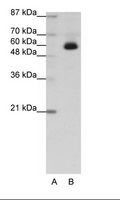 ZNF307 Antibody - Transfected 293T Cell Lysate.  This image was taken for the unconjugated form of this product. Other forms have not been tested.