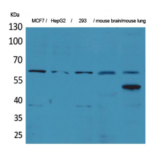 ZNF307 Antibody - Western blot of ZKSCAN4 antibody