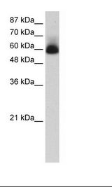 ZNF307 Antibody - Transfected 293T Cell Lysate.  This image was taken for the unconjugated form of this product. Other forms have not been tested.