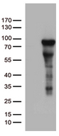 ZNF317 Antibody - HEK293T cells were transfected with the pCMV6-ENTRY control. (Left lane) or pCMV6-ENTRY ZNF317. (Right lane) cDNA for 48 hrs and lysed