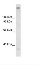 ZNF318 Antibody - Fetal Stomach Lysate.  This image was taken for the unconjugated form of this product. Other forms have not been tested.