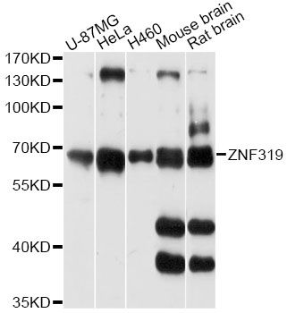 ZNF319 Antibody - Western blot analysis of extracts of various cell lines, using ZNF319 antibody at 1:3000 dilution. The secondary antibody used was an HRP Goat Anti-Rabbit IgG (H+L) at 1:10000 dilution. Lysates were loaded 25ug per lane and 3% nonfat dry milk in TBST was used for blocking. An ECL Kit was used for detection and the exposure time was 30s.