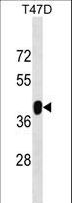 ZNF322 Antibody - ZNF322A Antibody western blot of T47D cell line lysates (35 ug/lane). The ZNF322A antibody detected the ZNF322A protein (arrow).
