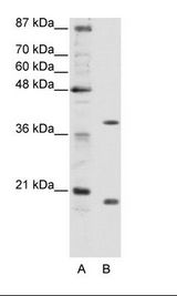 ZNF322 Antibody - A: Marker, B: HepG2 Cell Lysate.  This image was taken for the unconjugated form of this product. Other forms have not been tested.