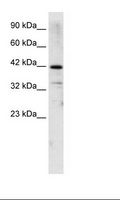 ZNF323 Antibody - Jurkat Cell Lysate.  This image was taken for the unconjugated form of this product. Other forms have not been tested.