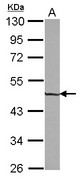 ZNF323 Antibody - Sample (30 ug of whole cell lysate) A: HeLa 10% SDS PAGE ZNF323 antibody diluted at 1:5000
