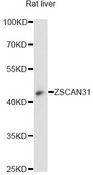 ZNF323 Antibody - Western blot analysis of extracts of rat liver, using ZSCAN31 antibody at 1:3000 dilution. The secondary antibody used was an HRP Goat Anti-Rabbit IgG (H+L) at 1:10000 dilution. Lysates were loaded 25ug per lane and 3% nonfat dry milk in TBST was used for blocking. An ECL Kit was used for detection and the exposure time was 90s.