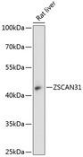 ZNF323 Antibody - Western blot analysis of extracts of rat liver using ZSCAN31 Polyclonal Antibody at dilution of 1:3000.