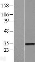 ZNF323 Protein - Western validation with an anti-DDK antibody * L: Control HEK293 lysate R: Over-expression lysate