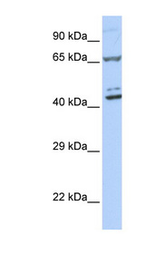 ZNF324 / ZF5128 Antibody - ZNF324 antibody Western blot of 721_B cell lysate. This image was taken for the unconjugated form of this product. Other forms have not been tested.