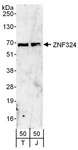 ZNF324 / ZF5128 Antibody - Detection of Human ZNF324 by Western Blot. Samples: Whole cell lysate from 293T (T; 50 ug) and Jurkat (J; 50 ug) cells. Antibodies: Affinity purified rabbit anti-ZNF324 antibody used for WB at 0.4 ug/ml. Detection: Chemiluminescence with an exposure time of 3 minutes.