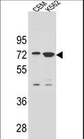 ZNF324 / ZF5128 Antibody - ZNF324B Antibody western blot of CEM and K562 cell line lysates (35 ug/lane). The ZNF324B antibody detected the ZNF324B protein (arrow).