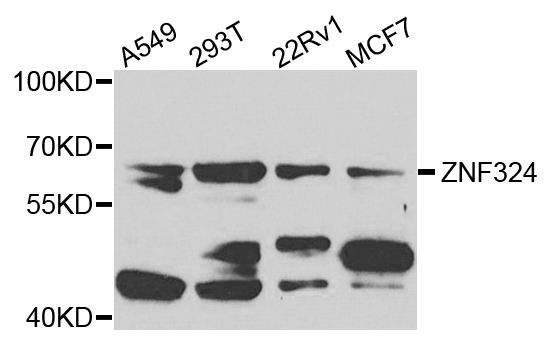 ZNF324 / ZF5128 Antibody - Western blot analysis of extracts of various cells.