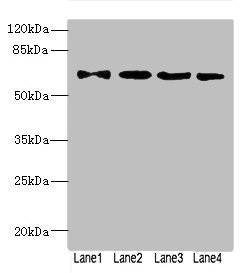 ZNF324 / ZF5128 Antibody - Western blot All Lanes: ZNF324antibody at 1.57ug/ml Lane 1 : A549 whole cell lysate Lane 2 : 293T whole cell lysate Lane 3 : MCF7 whole cell lysate Lane 4 : Jurkat whole cell lysate Secondary Goat polyclonal to Rabbit IgG at 1/10000 dilution Predicted band size: 61 kDa Observed band size: 61 kDa