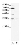 ZNF326 / Zfp326 Antibody - A: Marker, B: HepG2 Cell Lysate.  This image was taken for the unconjugated form of this product. Other forms have not been tested.