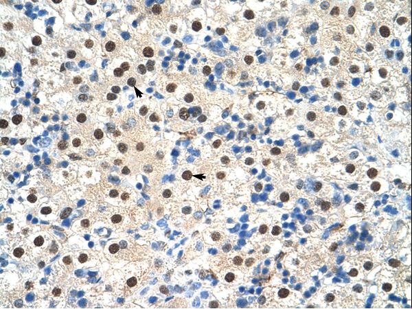 ZNF326 / Zfp326 Antibody - ZNF326 antibody ARP40068_T100-NP_892021-ZNF326(zinc finger protein 326) Antibody was used in IHC to stain formalin-fixed, paraffin-embedded human liver.  This image was taken for the unconjugated form of this product. Other forms have not been tested.