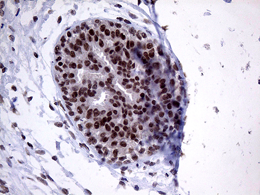 ZNF329 Antibody - Immunohistochemical staining of paraffin-embedded Human breast tissue within the normal limits using anti-ZNF329 mouse monoclonal antibody. (Heat-induced epitope retrieval by 1mM EDTA in 10mM Tris buffer. (pH8.5) at 120°C for 3 min. (1:150)