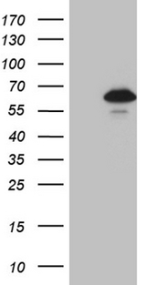ZNF329 Antibody - HEK293T cells were transfected with the pCMV6-ENTRY control. (Left lane) or pCMV6-ENTRY ZNF329. (Right lane) cDNA for 48 hrs and lysed. Equivalent amounts of cell lysates. (5 ug per lane) were separated by SDS-PAGE and immunoblotted with anti-ZNF329. (1:2000)