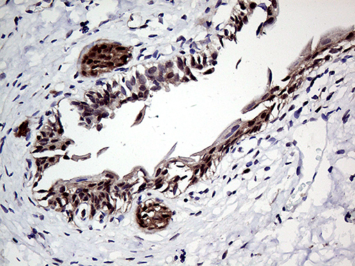 ZNF329 Antibody - Immunohistochemical staining of paraffin-embedded Human bladder tissue within the normal limits using anti-ZNF329 mouse monoclonal antibody. (Heat-induced epitope retrieval by 1mM EDTA in 10mM Tris buffer. (pH8.5) at 120°C for 3 min. (1:2000)