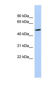ZNF329 Antibody - ZNF329 antibody Western blot of MCF7 cell lysate. This image was taken for the unconjugated form of this product. Other forms have not been tested.