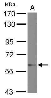 ZNF329 Antibody - Sample (30 ug of whole cell lysate) A: MCF-7 7.5% SDS PAGE ZNF329 antibody diluted at 1:2000