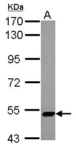 ZNF329 Antibody - Sample (30 ug of whole cell lysate) A: NT2D1 7.5% SDS PAGE ZNF329 antibody diluted at 1:1000