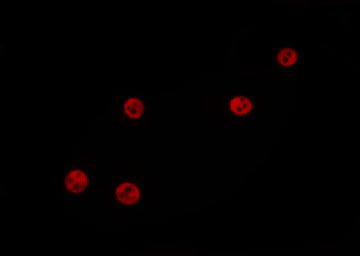 ZNF329 Antibody - Staining MCF-7 cells by IF/ICC. The samples were fixed with PFA and permeabilized in 0.1% Triton X-100, then blocked in 10% serum for 45 min at 25°C. The primary antibody was diluted at 1:200 and incubated with the sample for 1 hour at 37°C. An Alexa Fluor 594 conjugated goat anti-rabbit IgG (H+L) Ab, diluted at 1/600, was used as the secondary antibody.