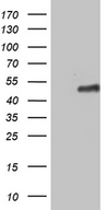 ZNF330 Antibody - HEK293T cells were transfected with the pCMV6-ENTRY control. (Left lane) or pCMV6-ENTRY ZNF330. (Right lane) cDNA for 48 hrs and lysed. Equivalent amounts of cell lysates. (5 ug per lane) were separated by SDS-PAGE and immunoblotted with anti-ZNF330. (1:2000)