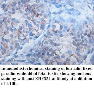 ZNF331 Antibody