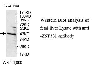 ZNF331 Antibody