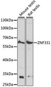 ZNF331 Antibody - Western blot analysis of extracts of various cell lines, using ZNF331 antibody at 1:1000 dilution. The secondary antibody used was an HRP Goat Anti-Rabbit IgG (H+L) at 1:10000 dilution. Lysates were loaded 25ug per lane and 3% nonfat dry milk in TBST was used for blocking. An ECL Kit was used for detection and the exposure time was 10s.
