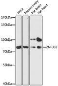ZNF333 Antibody - Western blot analysis of extracts of various cell lines, using ZNF333 antibody at 1:3000 dilution. The secondary antibody used was an HRP Goat Anti-Rabbit IgG (H+L) at 1:10000 dilution. Lysates were loaded 25ug per lane and 3% nonfat dry milk in TBST was used for blocking. An ECL Kit was used for detection and the exposure time was 90s.