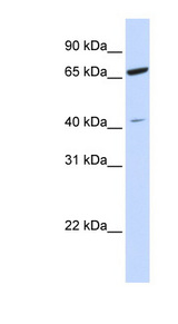 ZNF334 Antibody - ZNF334 antibody Western blot of HeLa lysate. This image was taken for the unconjugated form of this product. Other forms have not been tested.