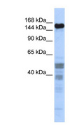 ZNF335 / NIF1 Antibody - ZNF335 antibody Western blot of Fetal Brain lysate. This image was taken for the unconjugated form of this product. Other forms have not been tested.