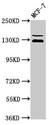 ZNF335 / NIF1 Antibody - Western Blot Positive WB detected in: MCF-7 whole cell lysate All lanes: ZNF335 antibody at 3.5µg/ml Secondary Goat polyclonal to rabbit IgG at 1/50000 dilution Predicted band size: 145, 130 kDa Observed band size: 145, 130 kDa