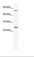 ZNF337 Antibody - Jurkat Cell Lysate.  This image was taken for the unconjugated form of this product. Other forms have not been tested.