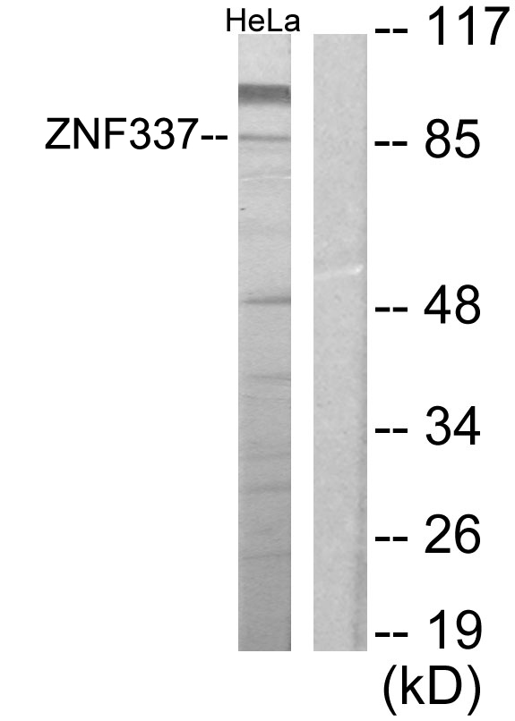 ZNF337 Antibody - Western blot analysis of lysates from HeLa cells, using ZNF337 Antibody. The lane on the right is blocked with the synthesized peptide.