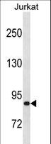 ZNF337 Antibody - ZNF337 Antibody western blot of Jurkat cell line lysates (35 ug/lane). The ZNF337 antibody detected the ZNF337 protein (arrow).
