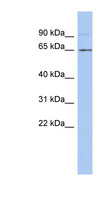 ZNF337 Antibody - ZNF337 antibody Western blot of PANC1 cell lysate. This image was taken for the unconjugated form of this product. Other forms have not been tested.