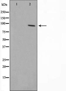 ZNF337 Antibody - Western blot analysis on HeLa cell lysates using ZNF337 antibody. The lane on the left is treated with the antigen-specific peptide.