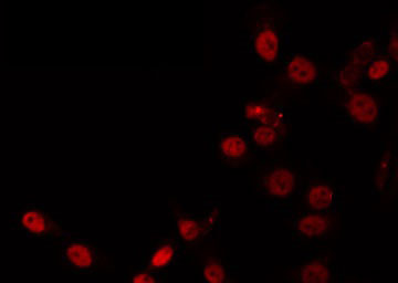ZNF337 Antibody - Staining HeLa cells by IF/ICC. The samples were fixed with PFA and permeabilized in 0.1% Triton X-100, then blocked in 10% serum for 45 min at 25°C. The primary antibody was diluted at 1:200 and incubated with the sample for 1 hour at 37°C. An Alexa Fluor 594 conjugated goat anti-rabbit IgG (H+L) Ab, diluted at 1/600, was used as the secondary antibody.
