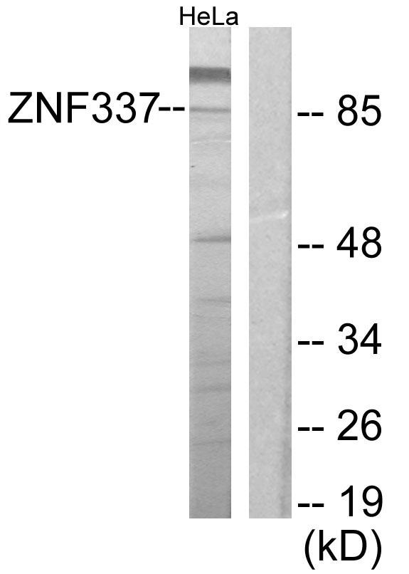 ZNF337 Antibody - Western blot analysis of extracts from HeLa cells, using ZNF337 antibody.