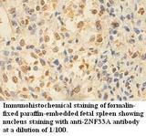 ZNF33A / KOX2 Antibody