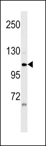 ZNF33A / KOX2 Antibody - ZNF33A Antibody western blot of HeLa cell line lysates (35 ug/lane). The ZNF33A Antibody detected the ZNF33A protein (arrow).