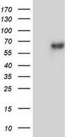 ZNF34 Antibody - HEK293T cells were transfected with the pCMV6-ENTRY control (Left lane) or pCMV6-ENTRY ZNF34 (Right lane) cDNA for 48 hrs and lysed. Equivalent amounts of cell lysates (5 ug per lane) were separated by SDS-PAGE and immunoblotted with anti-ZNF34.