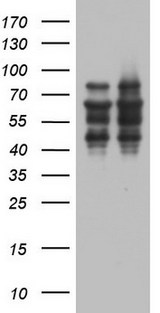 ZNF34 Antibody - HEK293T cells were transfected with the pCMV6-ENTRY control (Left lane) or pCMV6-ENTRY ZNF34 (Right lane) cDNA for 48 hrs and lysed. Equivalent amounts of cell lysates (5 ug per lane) were separated by SDS-PAGE and immunoblotted with anti-ZNF34.